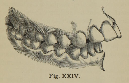 Fig. XXIV