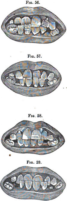 Fig.57-59