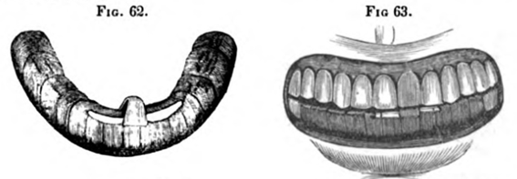 Fig.62.  Fig.63