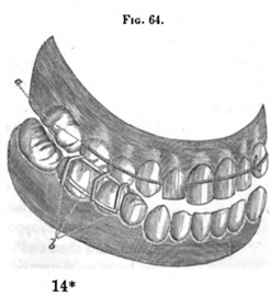 Fig.64.