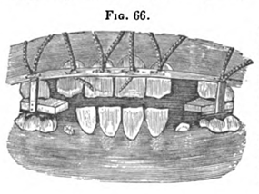 Fig.66.