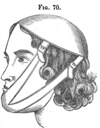 Fig.70.