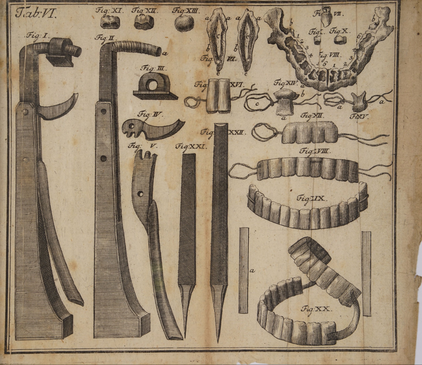 1756_Philipp Pfaff_図