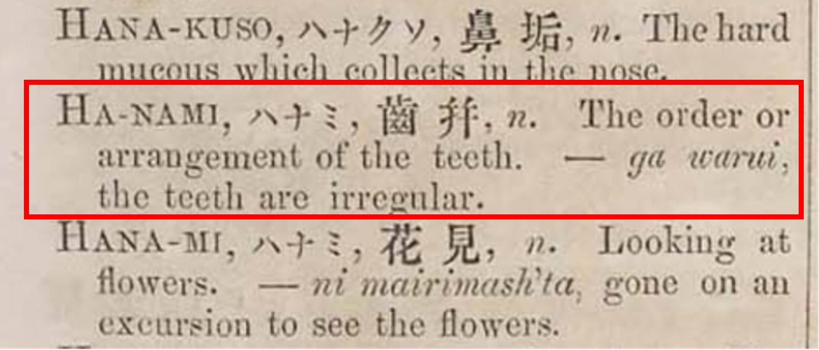 HANAMI_ハナミ_歯並