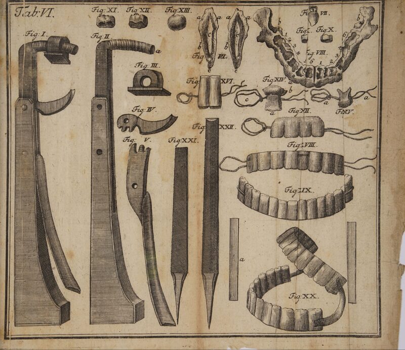 1756_Philipp Pfaff_�}