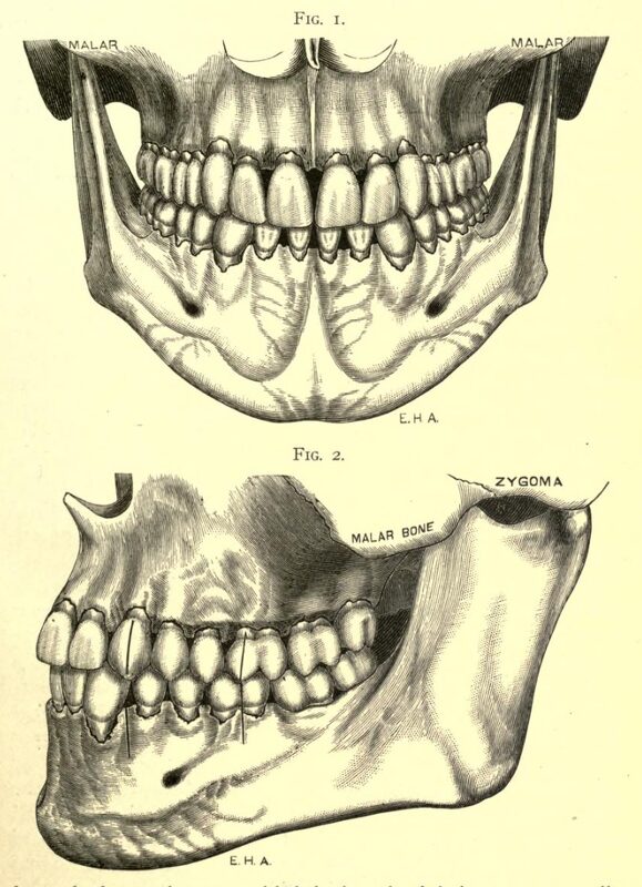 1898_Angle_Fig 1