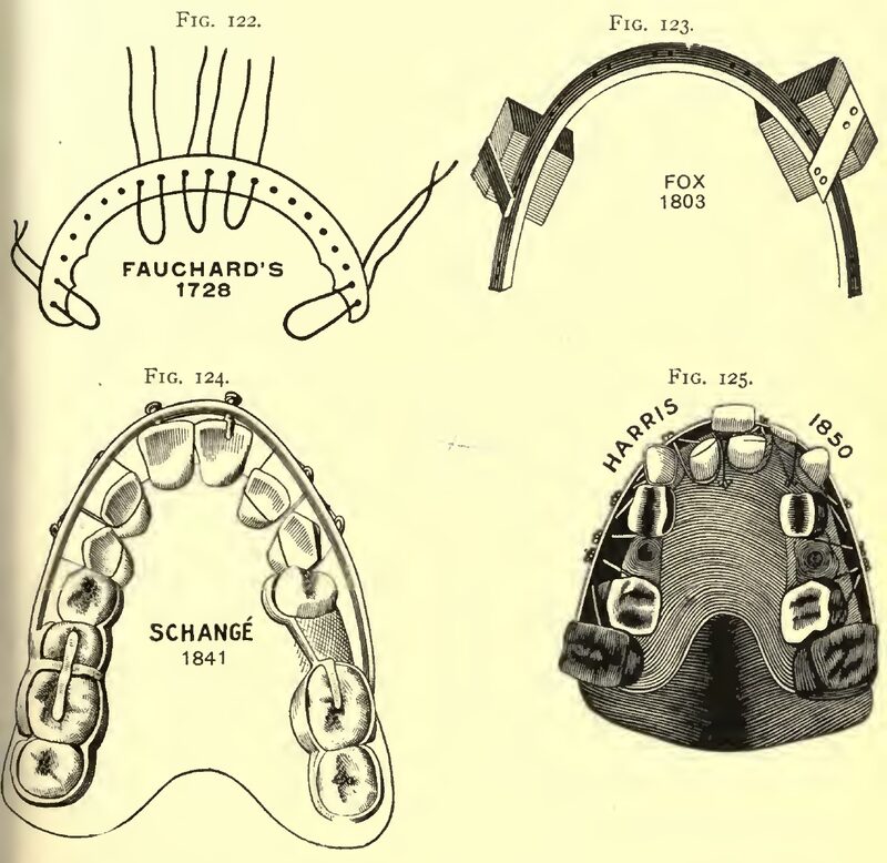 1898_Angle_Fig.122 123 124 125