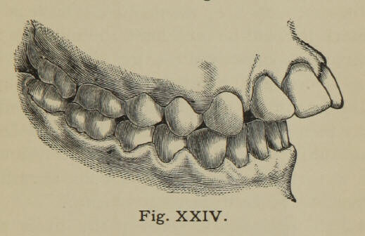 Fig. XXIV